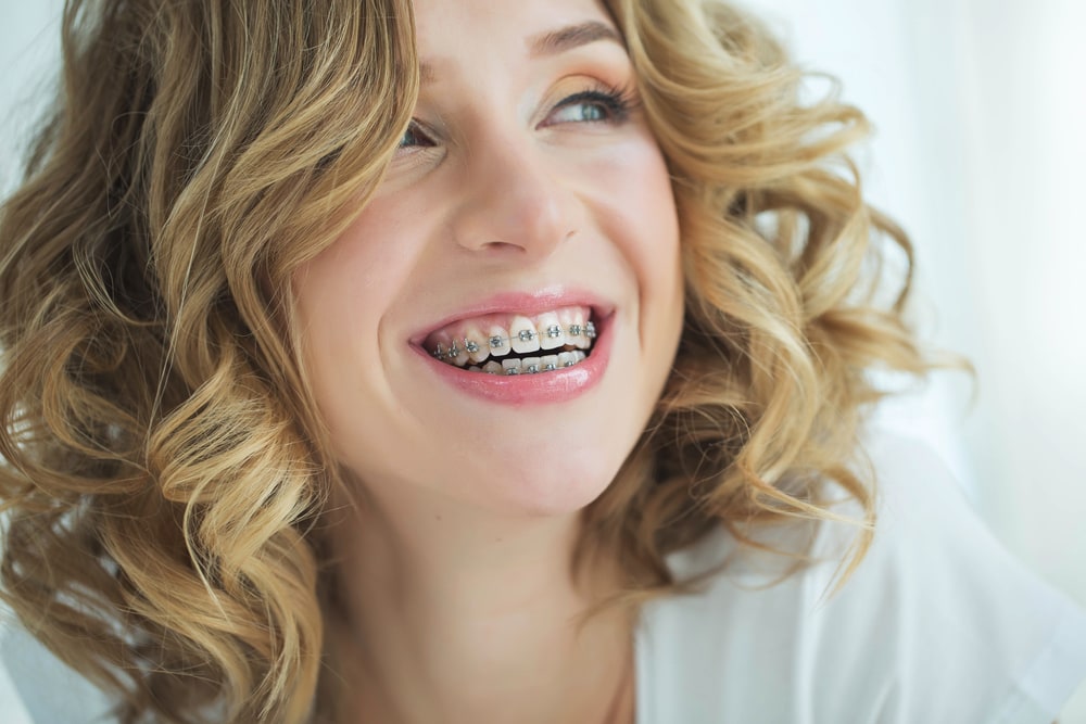 (VIDEO) How to Brand Your Orthodontics Practice